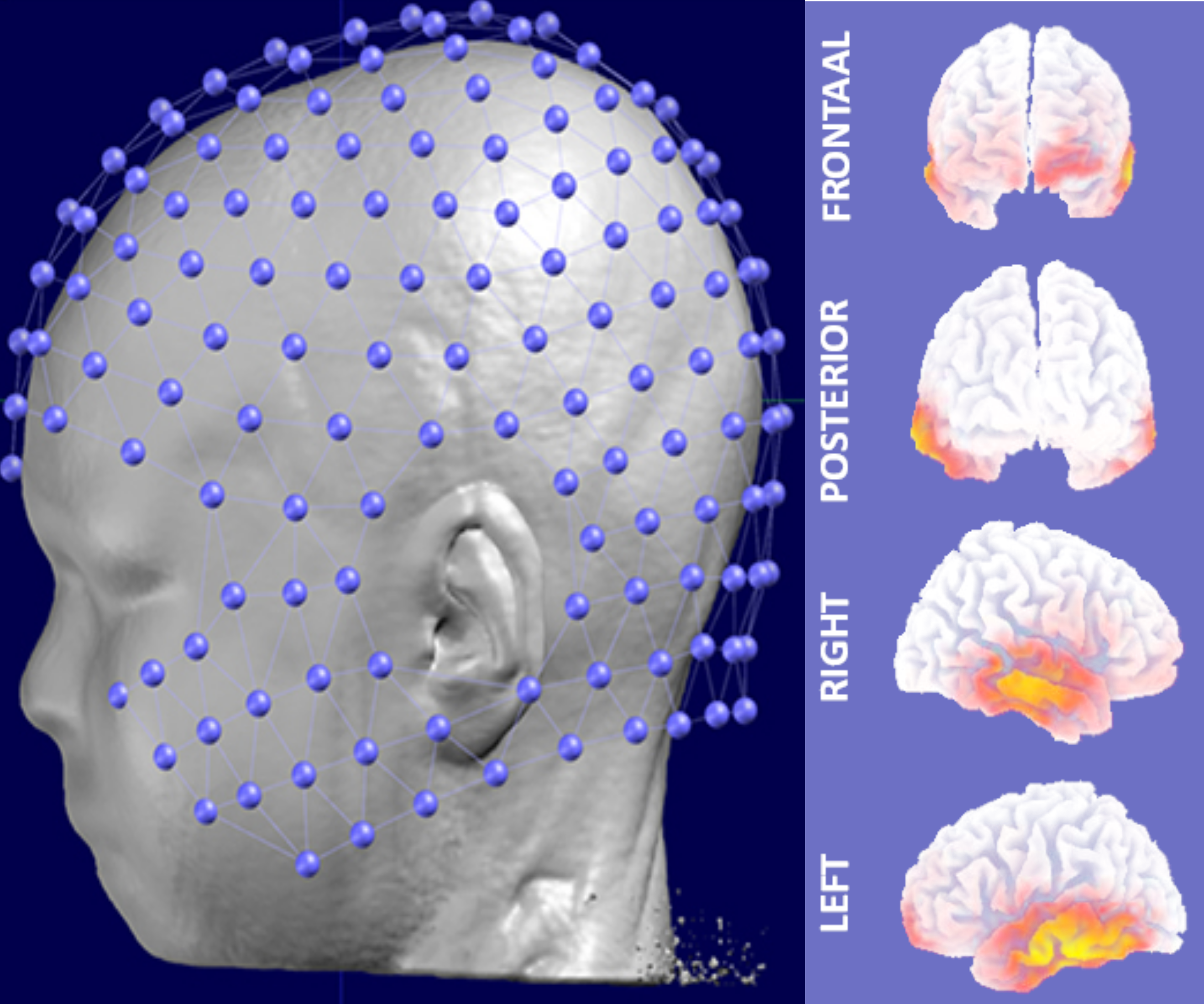 Interfacing and Detecting Auditory Neural Information